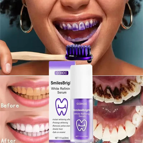 Purple Whitening Toothpaste – Get a Brighter Smile Instantly