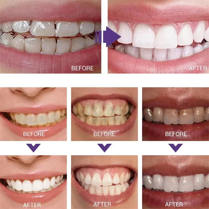 Purple Whitening Toothpaste – Get a Brighter Smile Instantly