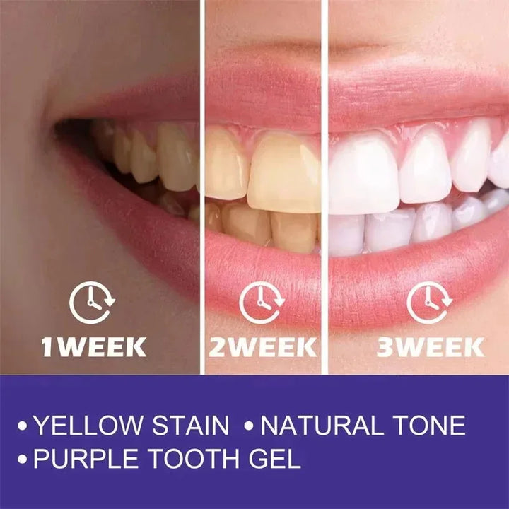 Purple Whitening Toothpaste – Get a Brighter Smile Instantly